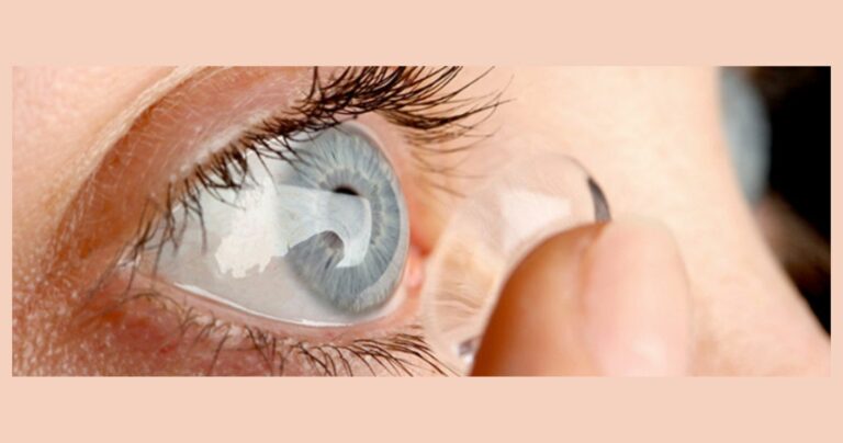 Lire la suite à propos de l’article Entretenir ses lentilles de contact